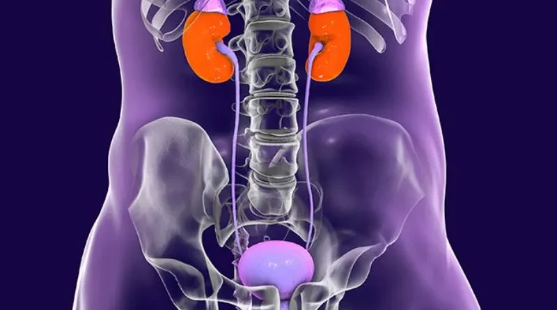 Bladder Scanner for Neurogenic Bladder